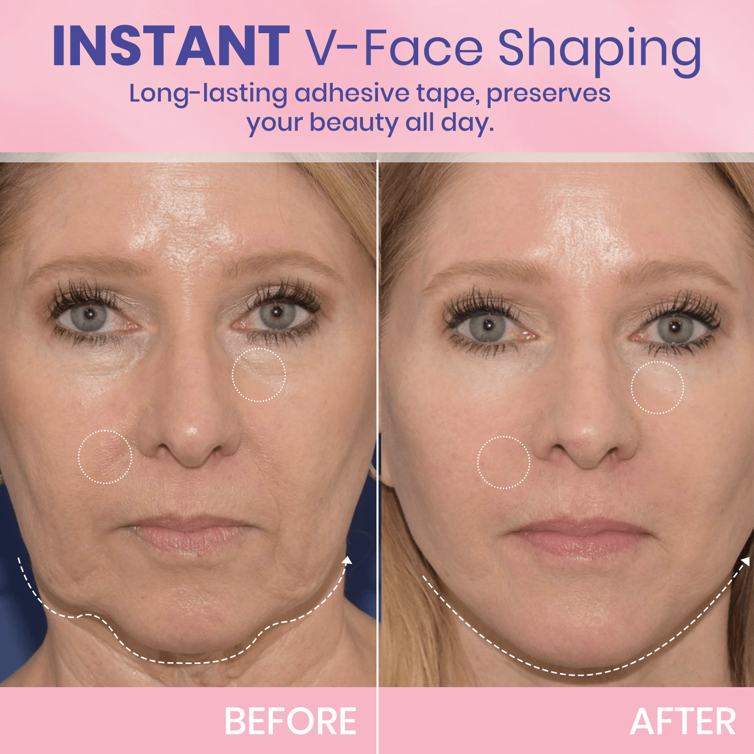 1+1 GRATIS! V-Face Lifting Tape | Jugendliche Ausstrahlung mit dem V-Face