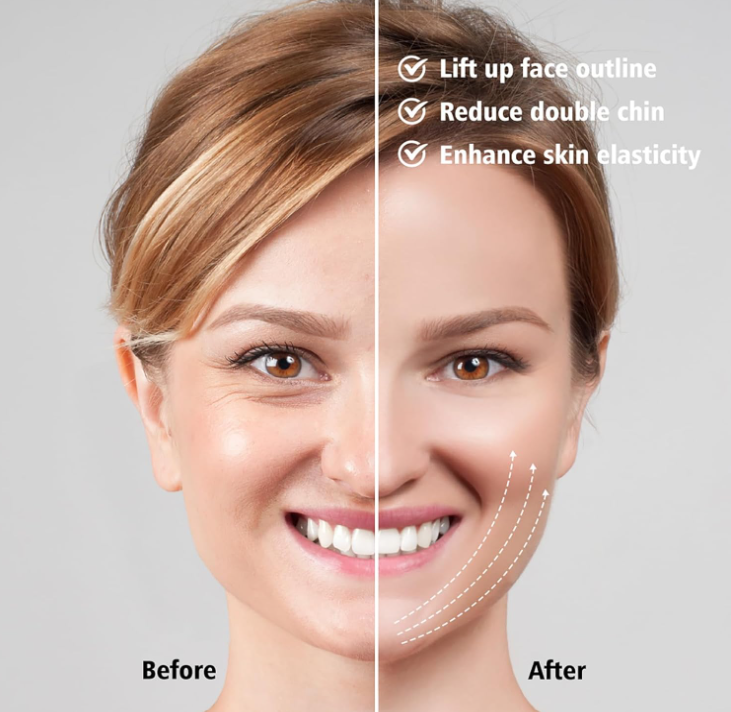 KinnlinienTrainer™ | Straffere Kinnlinie