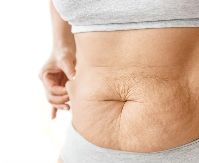 Belly Soothe™ | Bauchstraffende Creme