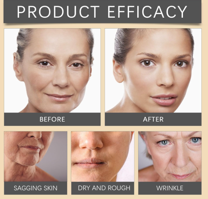 Anti-Falten™ | Botox Faltenentferner Creme