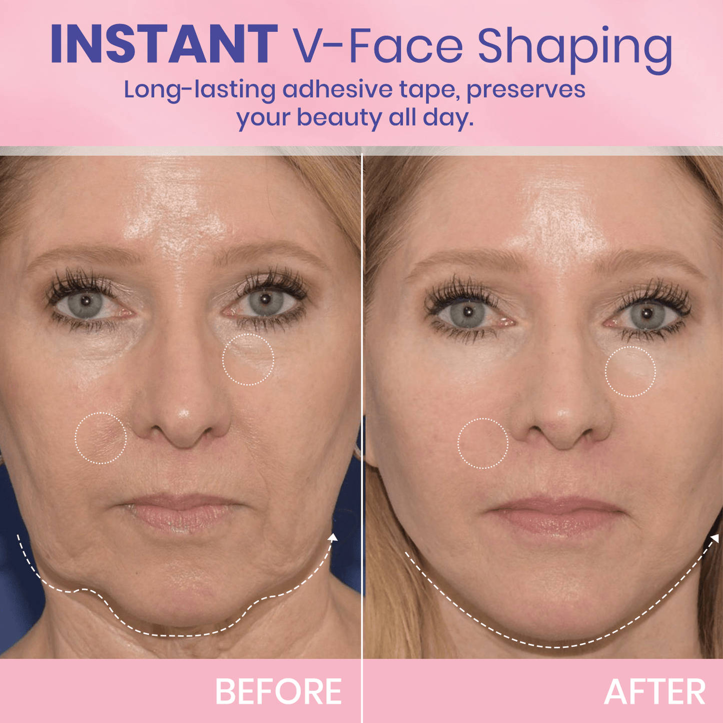 1+1 GRATIS! V-Face Lifting Tape | Jugendliche Ausstrahlung mit dem V-Face