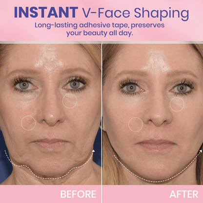 1+1 GRATIS! V-Face Lifting Tape | Jugendliche Ausstrahlung mit dem V-Face