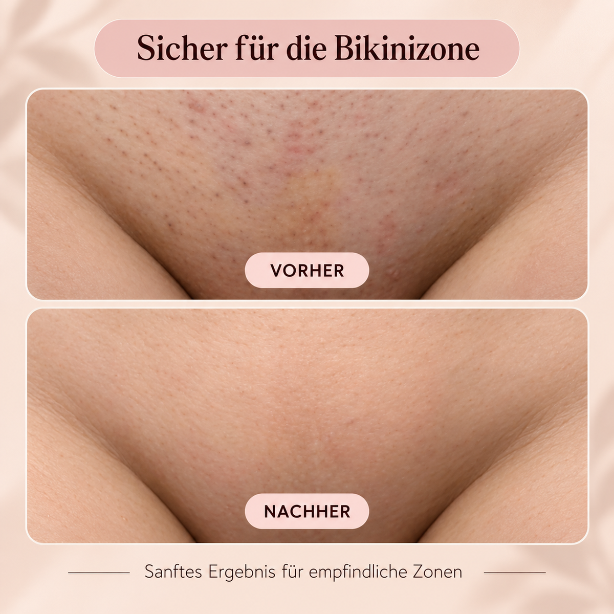 GlowShave™ | ClearSkin-Technologie