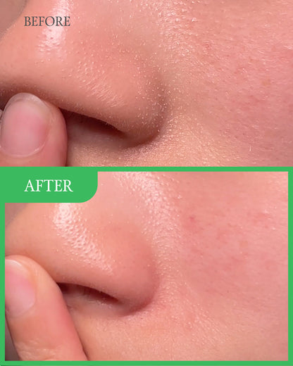 1+1 GRATIS!  Grüne Tomate™ | Maske Gesichtsreiniger