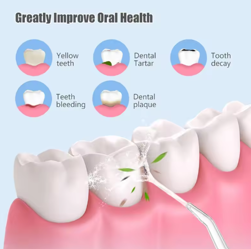 FlossMeister™ | Tragbare Wasserzahnreiniger