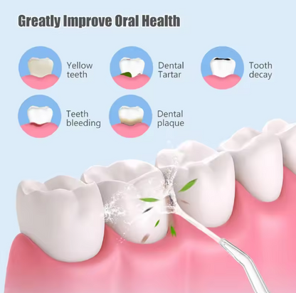 FlossMeister™ | Tragbare Wasserzahnreiniger