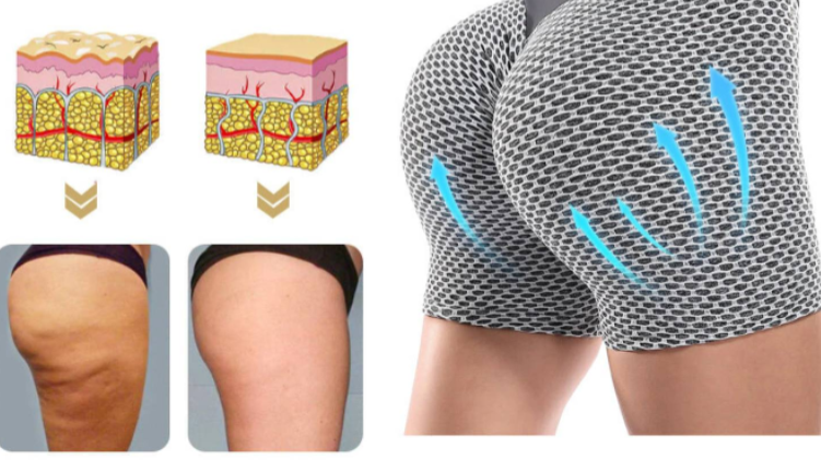 Fit™ | Ademende Hoge Taille Yoga Shorts