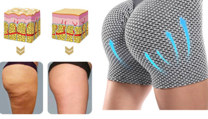 Fit™ | Ademende Hoge Taille Yoga Shorts