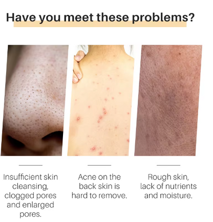 TurmaGlow™ | Kurkuma Seife