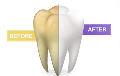 1+1 GRATIS! V34 WhiteGlow™ | Farbkorrektur Zahnpasta