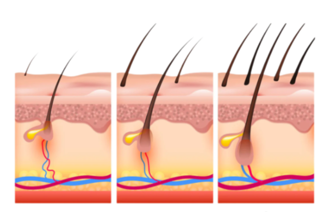 1+1 GRATIS! Rosmarinöl™ | Haarwachstum