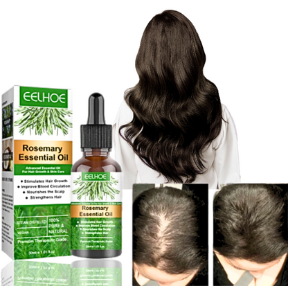 1+1 GRATIS! Rosmarinöl™ | Haarwachstum