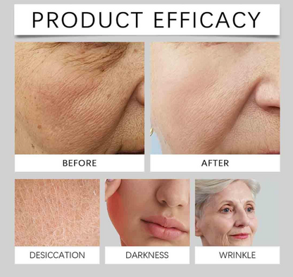 1+1 GRATIS! Vita C™ | Stelle deine Haut wieder her und gewinne deinen jugendlichen Glanz zurück