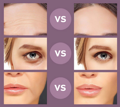 Gesichts-Massager™ | Jugendliche, straffe Haut in nur 5 Minuten pro Tag