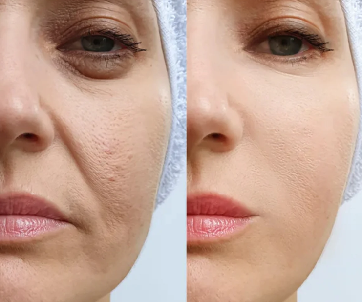 Gesichts-Massager™ | Jugendliche, straffe Haut in nur 5 Minuten pro Tag