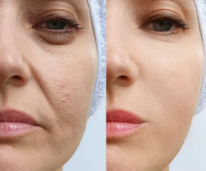 Gesichts-Massager™ | Jugendliche, straffe Haut in nur 5 Minuten pro Tag