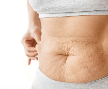 1+1 GRATIS! Belly Soothe™ | Bauchstraffende Creme