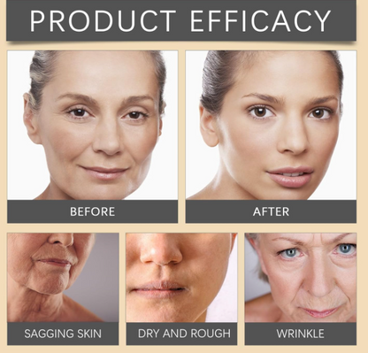1+1 GRATIS! Anti-Falten™ | Botox Faltenentferner Creme