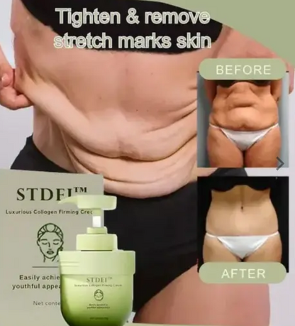 1+1 GRATIS! FIRMIVORA™ | Kollagen Straffende Creme