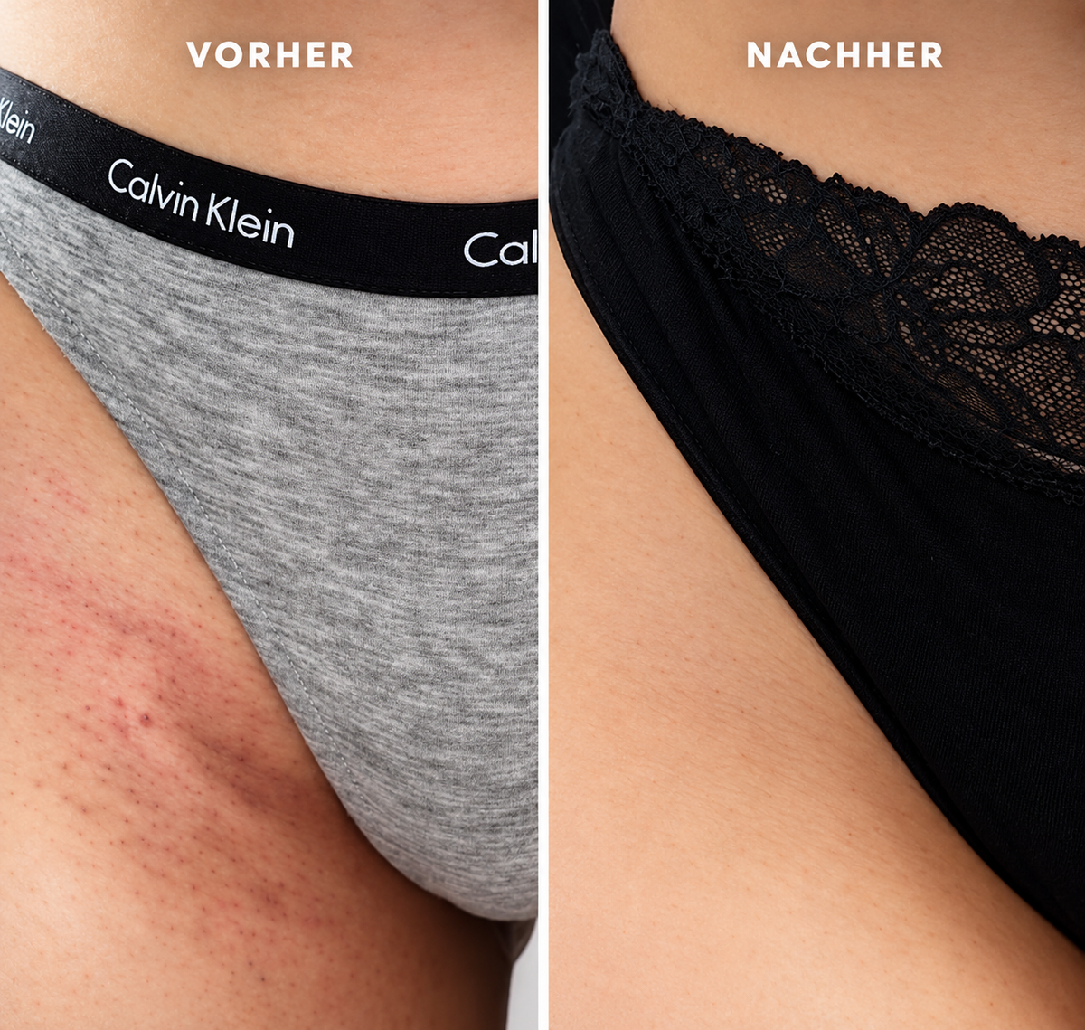 GlowShave™ | ClearSkin-Technologie