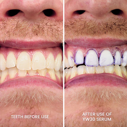 1+1 GRATIS! V34 WhiteGlow™ | Farbkorrektur Zahnpasta