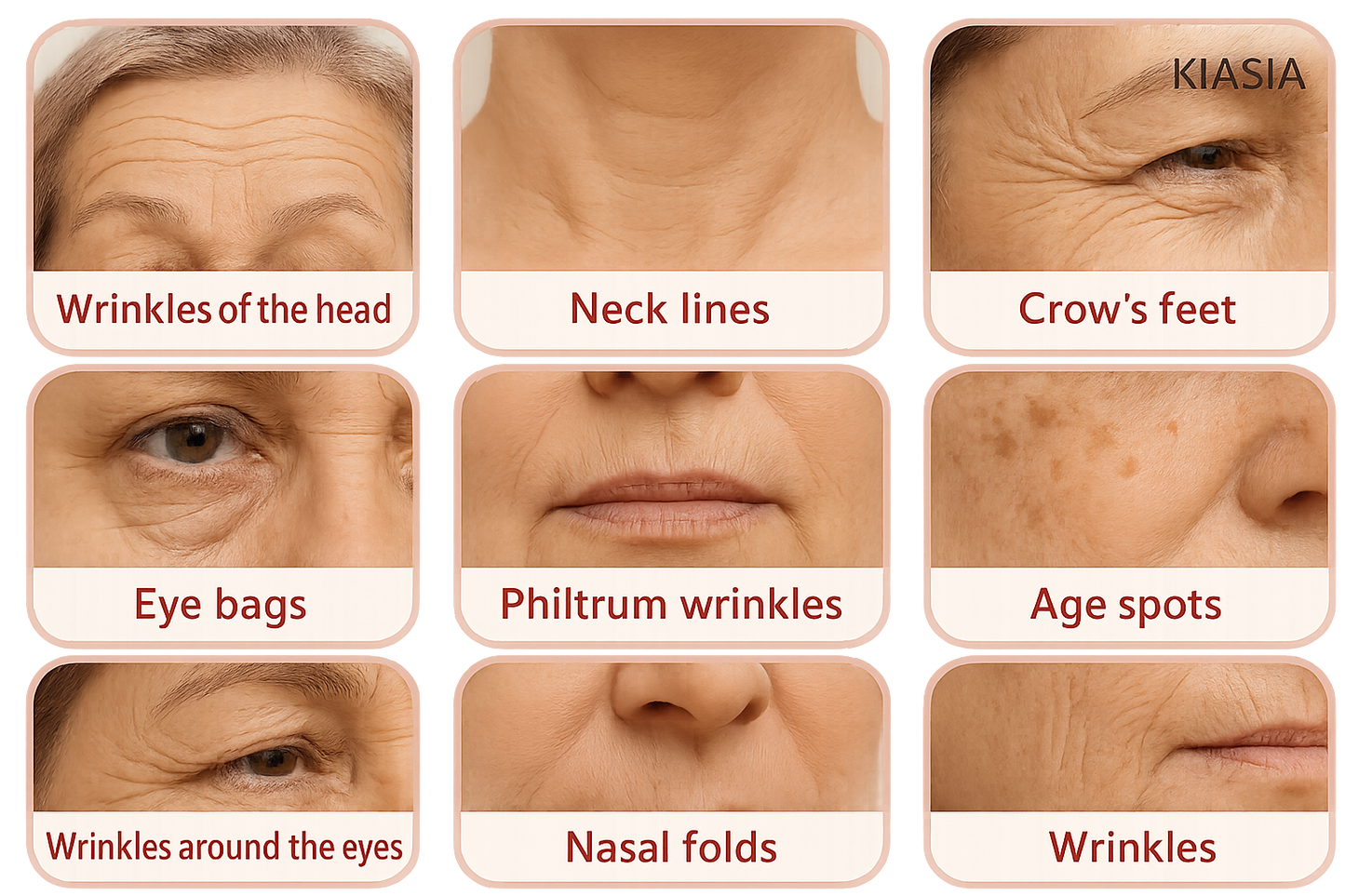 KIASIA huidproblemen overzicht met verschillende soorten rimpels en huidcondities