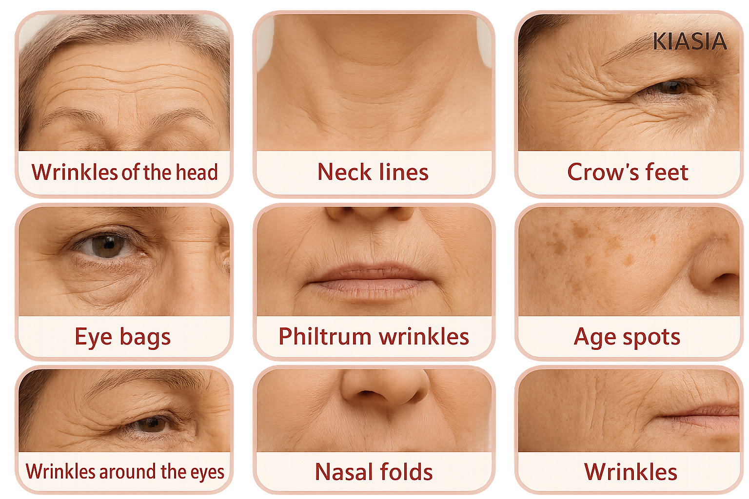 KIASIA huidproblemen overzicht met verschillende soorten rimpels en huidcondities