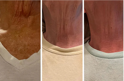 Halsstraffung™Crème | Pure Verstevigung und Lift