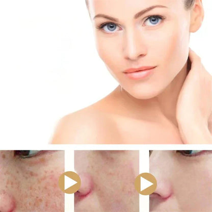 1+1 GRATIS! GlowGenix | Kurkuma Dunkle-Flecken-Aufhellungsserum