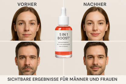 Voor- en na-vergelijking van lichter rood-oranje/koraal 5 in 1 Boost™ Gesichtsserum mit Hyaluronsäure und Vitamin E - Sichtbare Ergebnisse für Männer und Frauen
